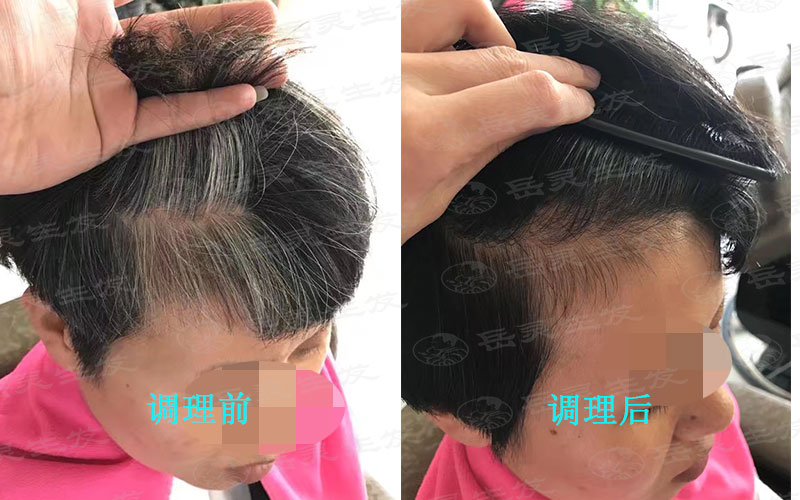染白發是不可取的養發方法