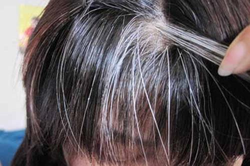 容易長白頭發的人應該如何預防白發