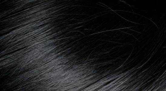 少年白頭吃什么可以變黑發