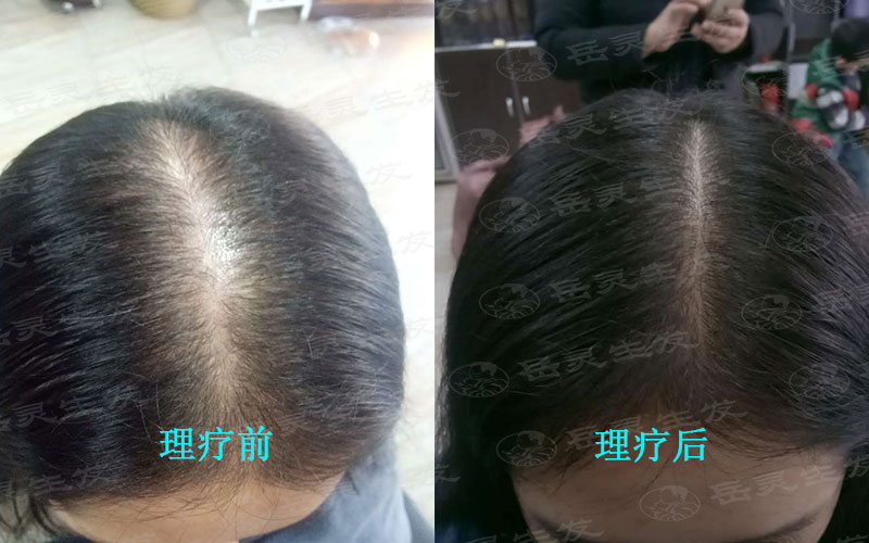 正確的養發護發才能防脫生發