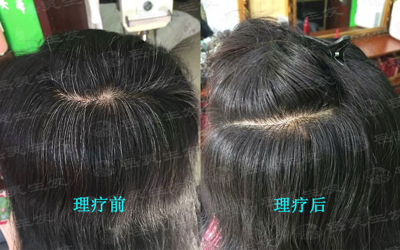 哪些養發護發有利于白發轉黑發