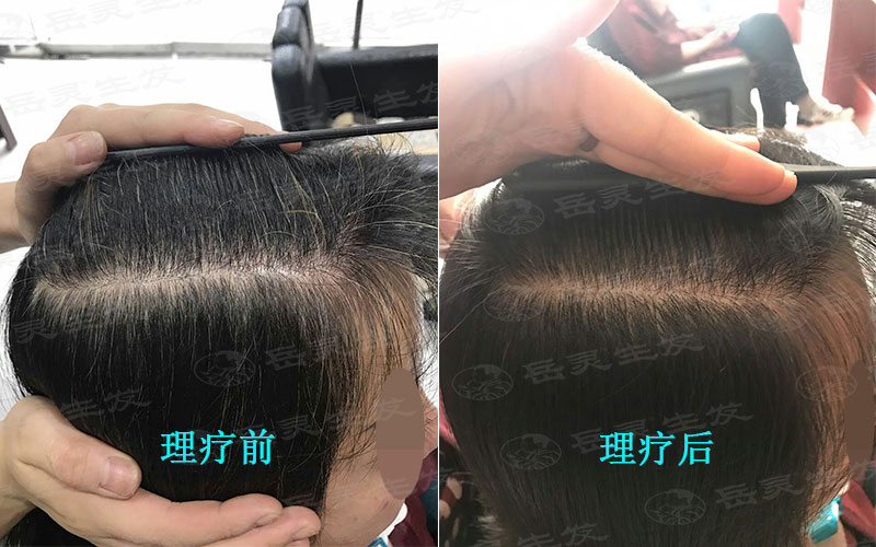 少白頭如何養發護發能白發轉黑發