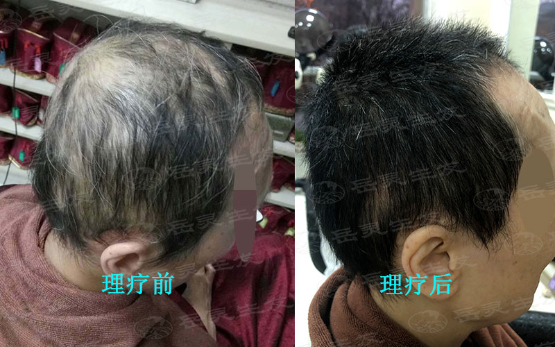 如何養發能夠防脫生發你知道嗎?