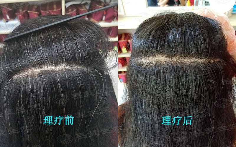 如何才能將白頭發變黑的養發方法