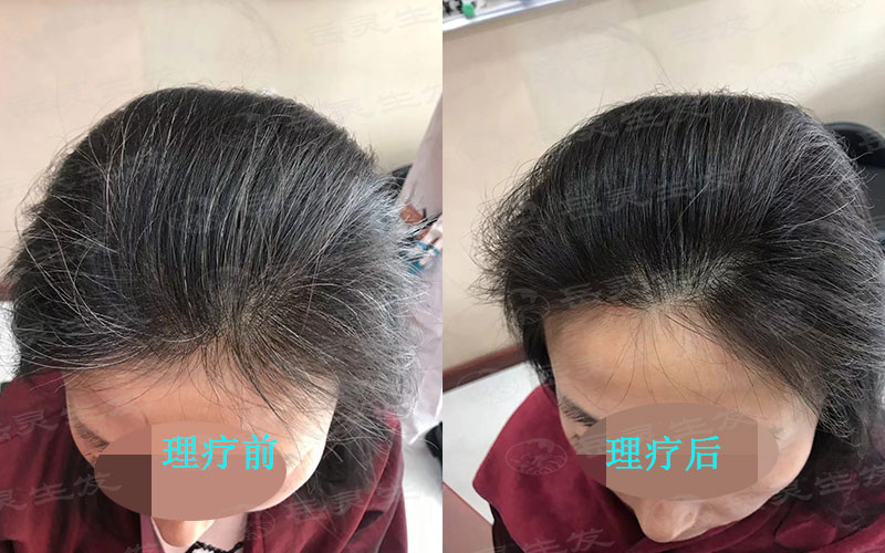 如何將白發變黑我們該如何養發