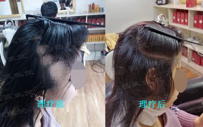 如何養發能更好的防脫生發呢
