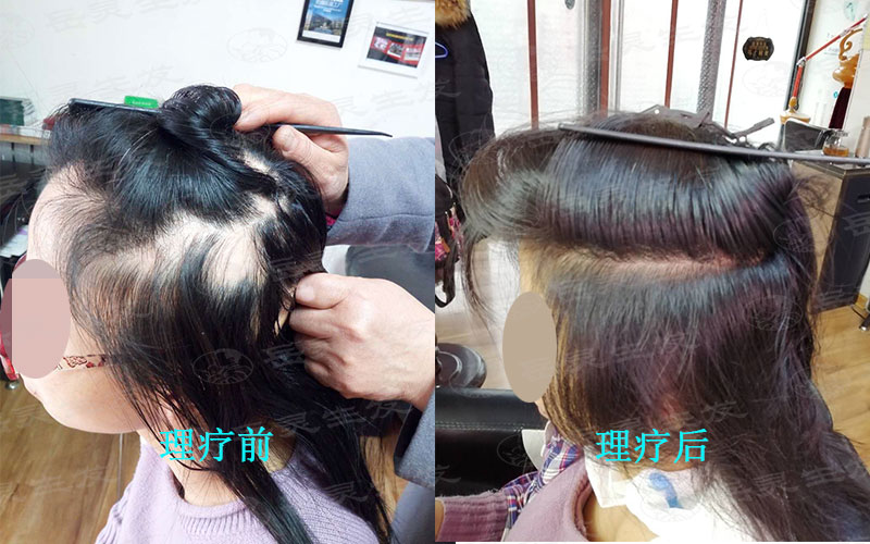 怎樣防脫發的養發注意事項內容