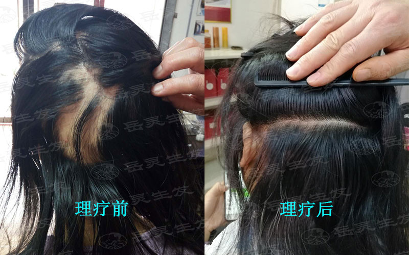 如何防脫生發的養發護發方法