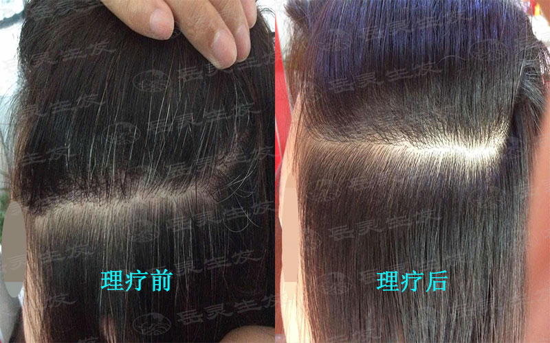 年輕人為什么也會長白頭發？