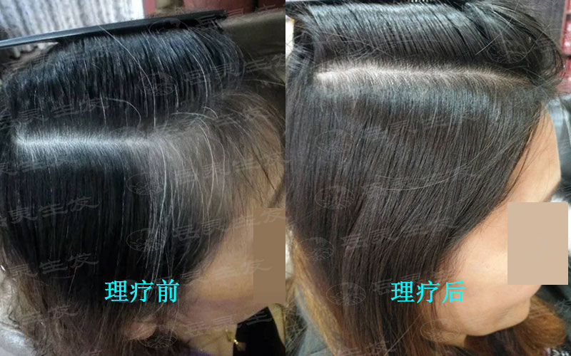 如何養發能將白頭發轉黑發