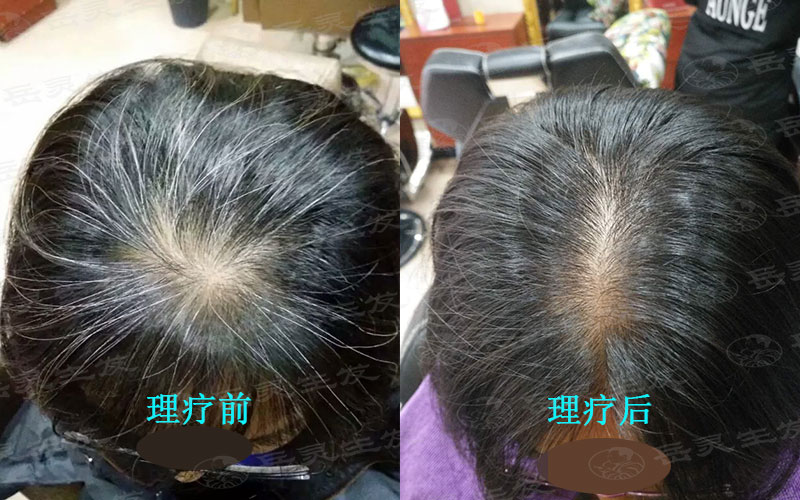 怎樣把白頭發養黑的方法