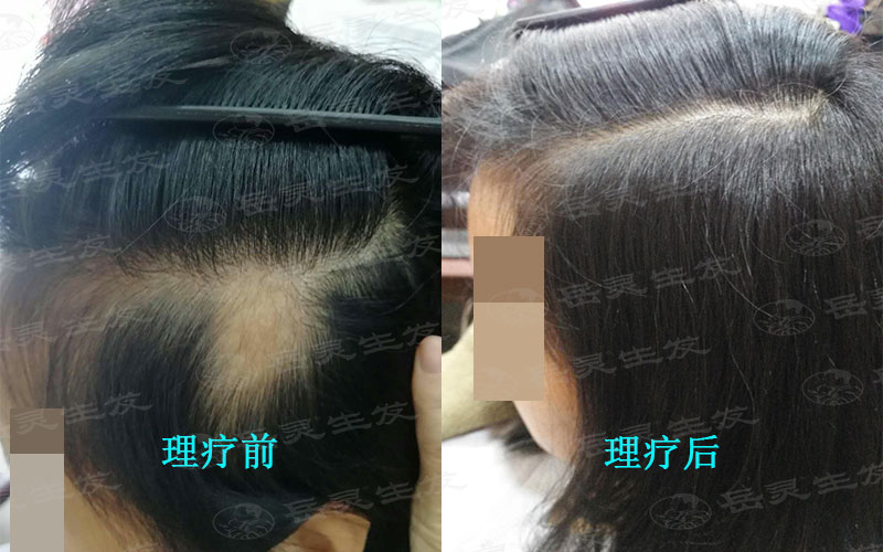防脫發方法你知道哪些