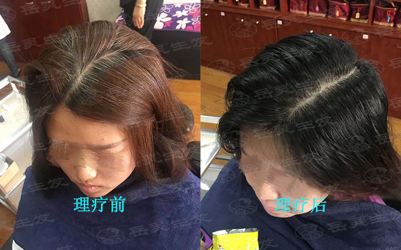 白發如何變黑大家知道嗎