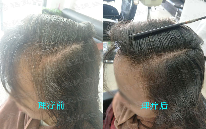 想要白發變黑就要知道其中的原因