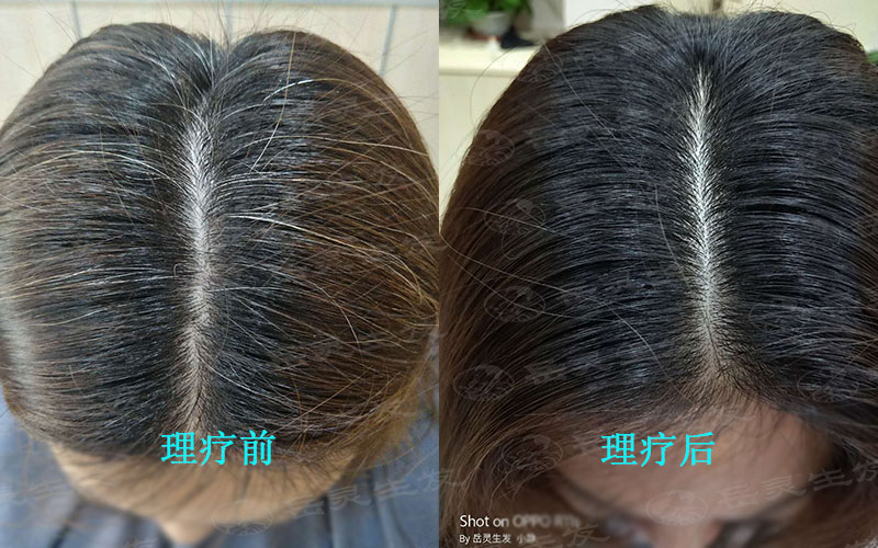 秋季白發的養發食物有哪些?