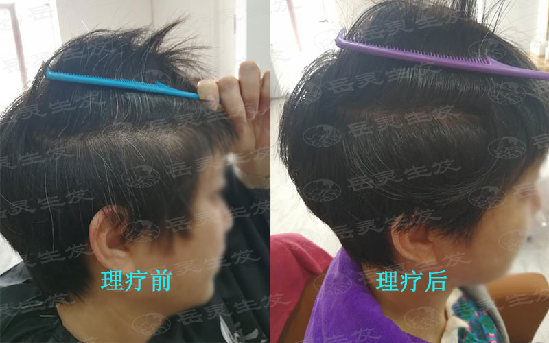 預防白發，從孩子抓起