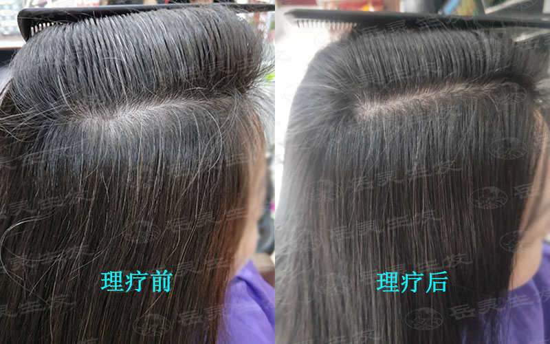 如何能使白發變黑的養護