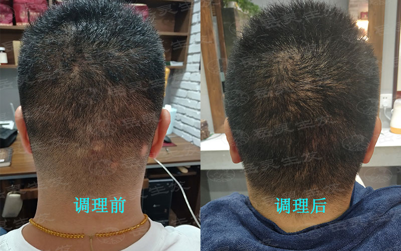 如何養發防脫這幾招讓你擺脫煩惱