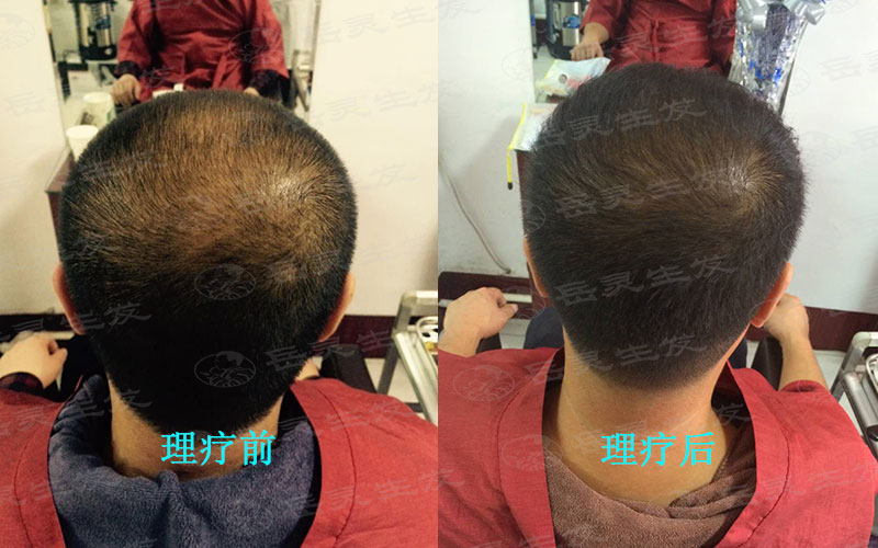 防脫生發(fā)是個(gè)長久的養(yǎng)發(fā)護(hù)發(fā)過程