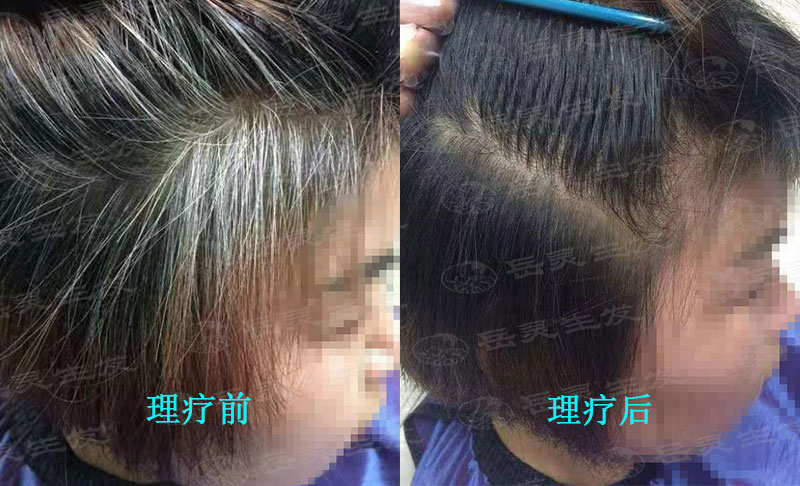 養發可以白發轉黑嗎