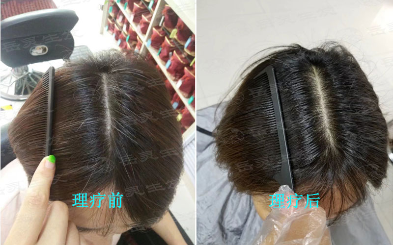 白發原因及變黑發的養發方法
