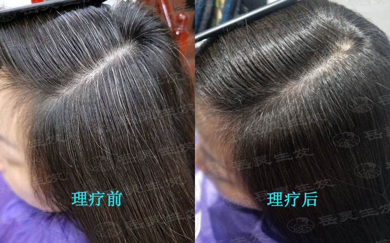 白發小知識教你如何變黑