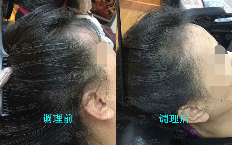 白發轉黑發的方法,這樣養發更好