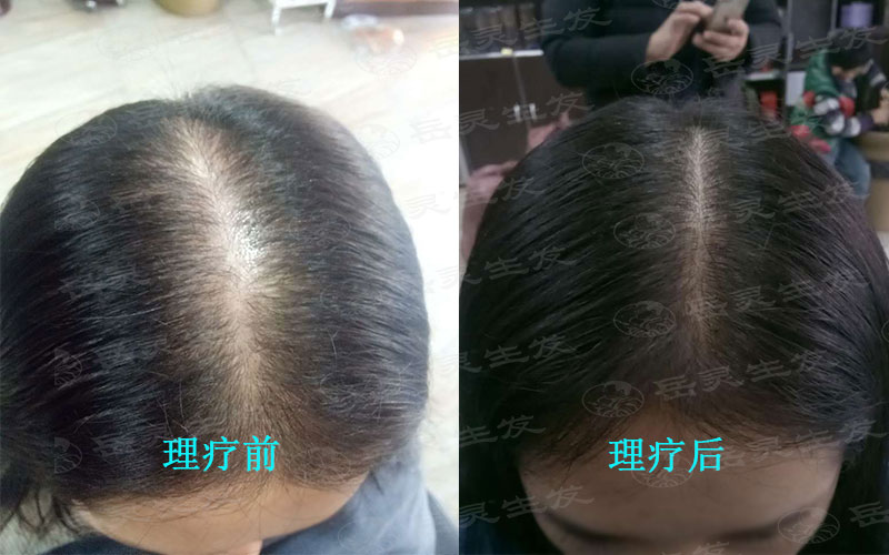 女孩日常防脫生發另發量倍增的辦法