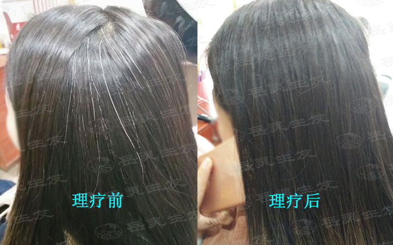 中醫告訴你白發轉黑發的方法
