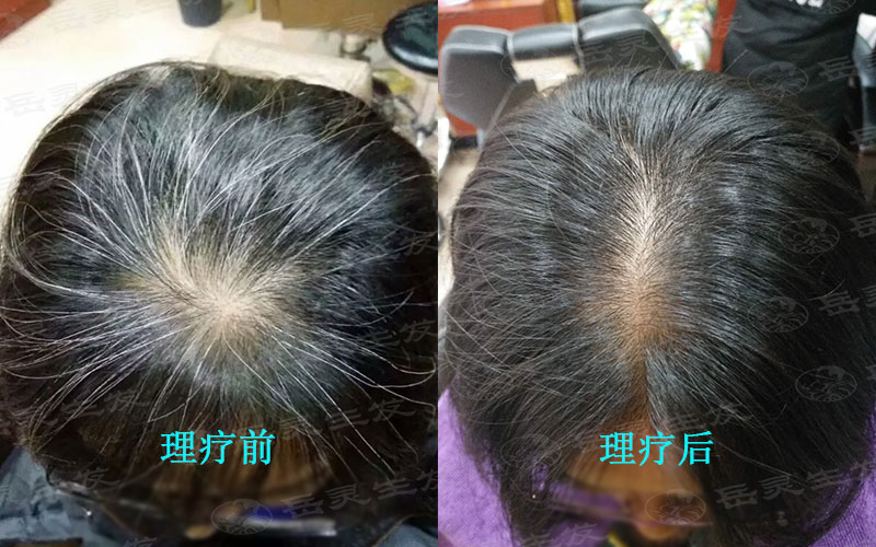 堅持這樣養發白發都會變黑變亮