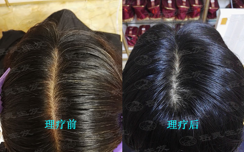 白發變黑的問題只需要注意這些養發事項