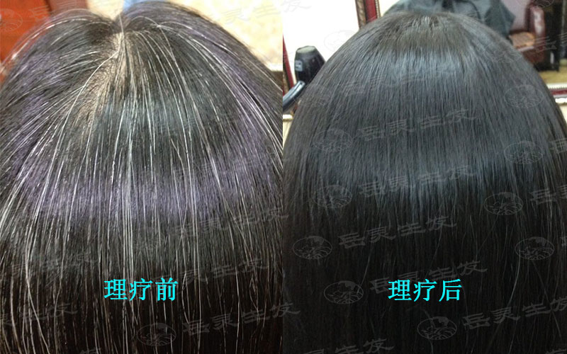 從頭發看身體教你健康白發轉黑