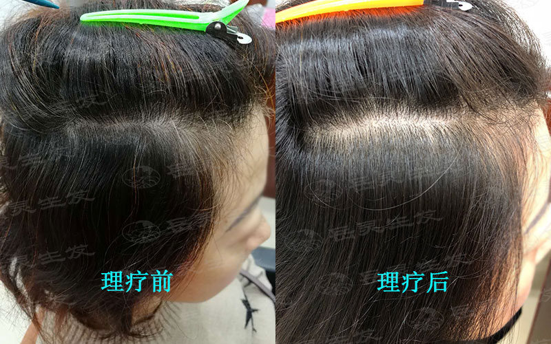 如何能使白發變黑的辦法