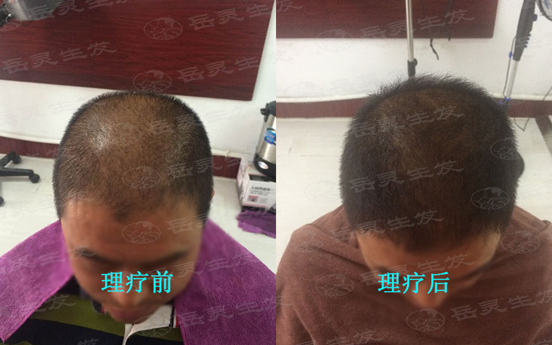2020年生發養發應該吃什么