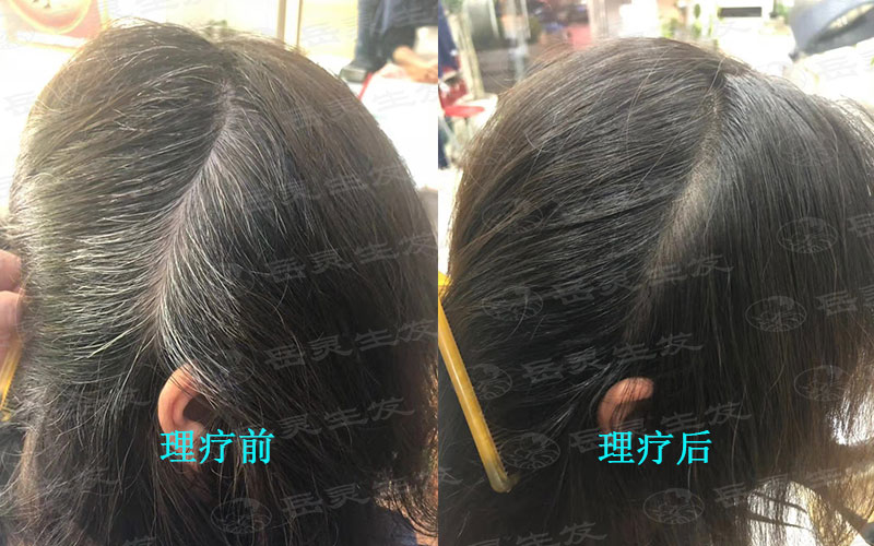 白頭發變黑的有效養發方法