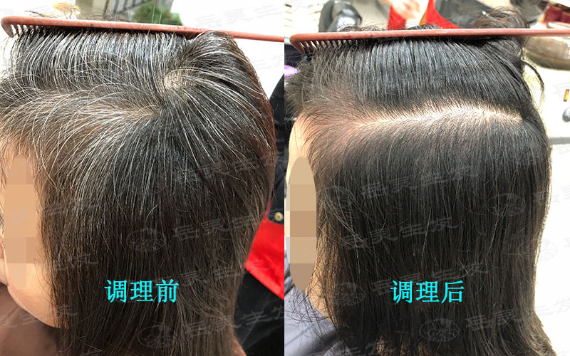 科學養發改善白發轉黑發