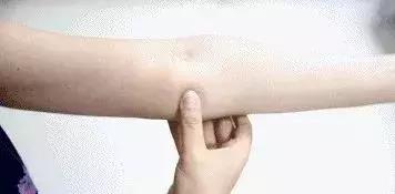 岳靈生發手肘內側穴位