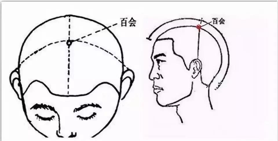 白發集中出現在頭頂部位是腎氣虛