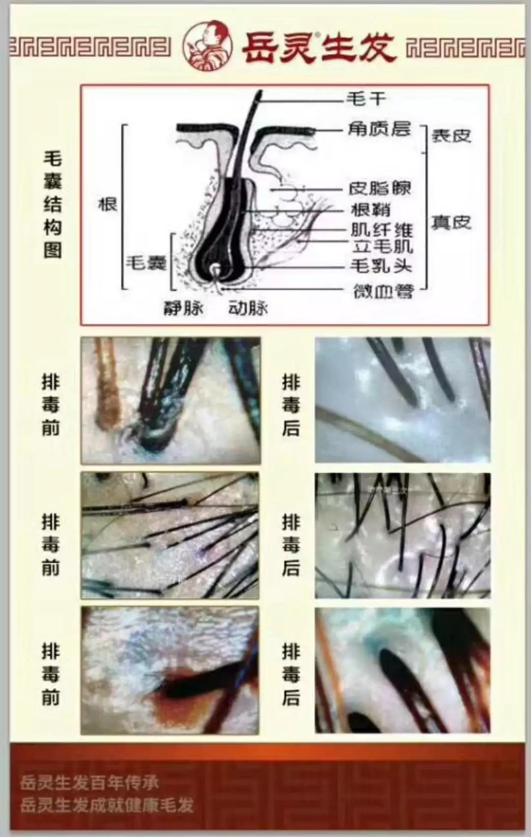 白發反復拔容易引發毛囊炎