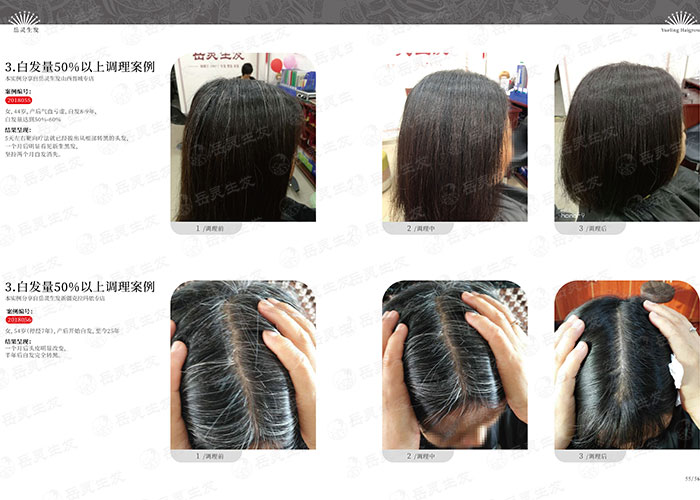 鬢角有白發預示著有什么疾病？如何才能變黑？