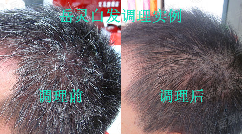 為什么會長白頭發？我們該怎么辦？