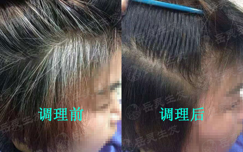 白頭發出現的原因及如何預防白發