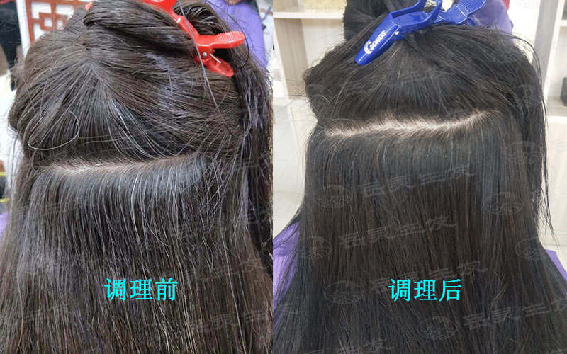 女人長白發都有哪些原因？