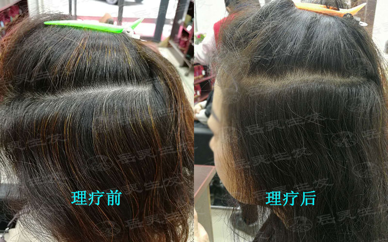 白發轉黑發你得先清楚其中的原因