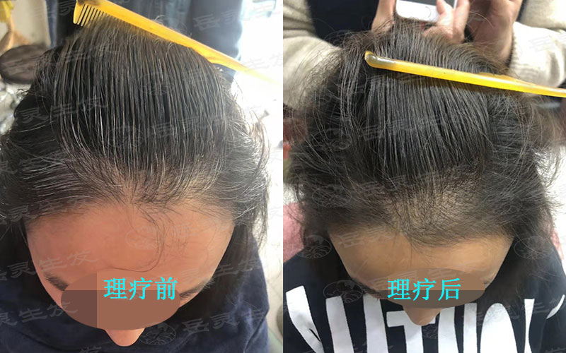 白頭發吃什么食物養發好?